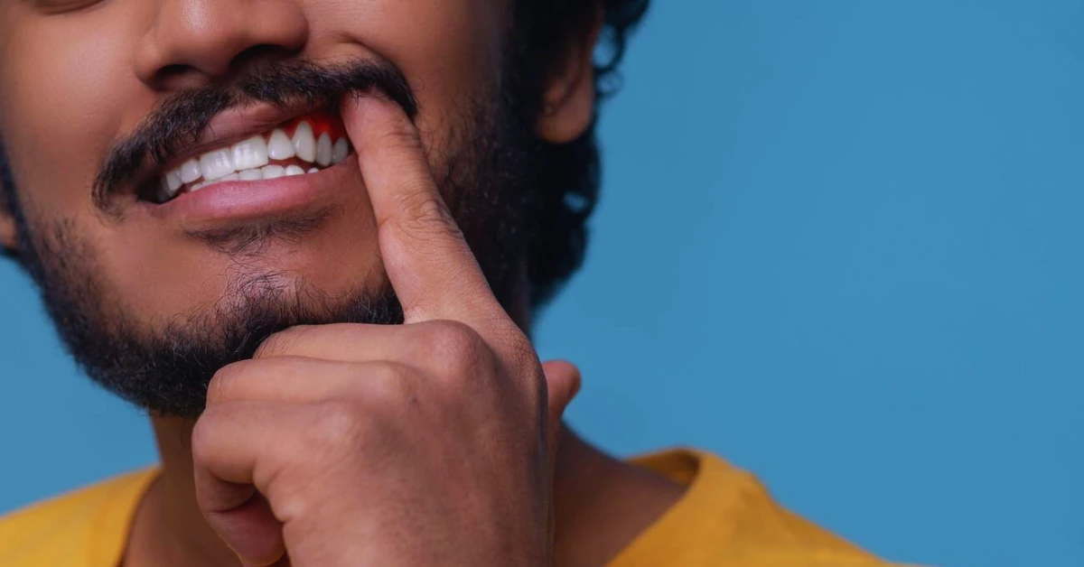Cure Gum Disease Without A Dentist