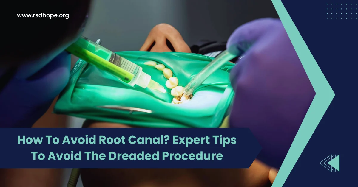 How To Avoid Root Canal