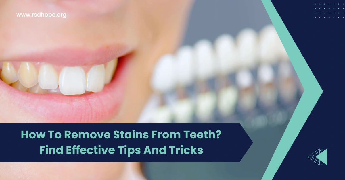 How To Remove Stains From Teeth
