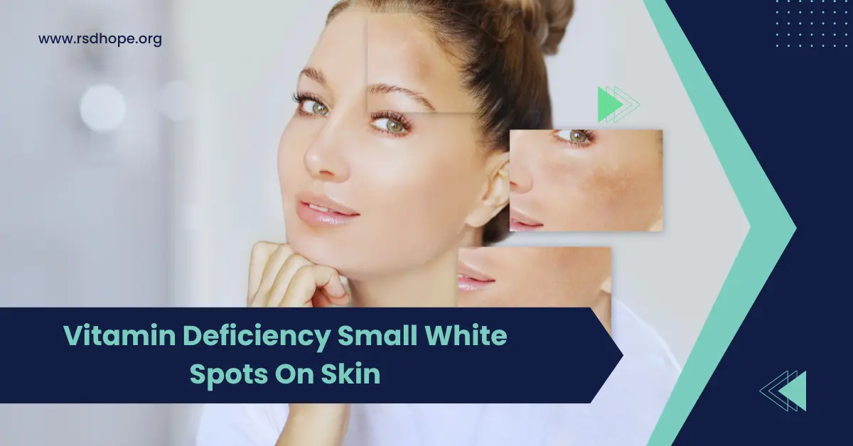 Vitamin Deficiency Small White Spots On Skin