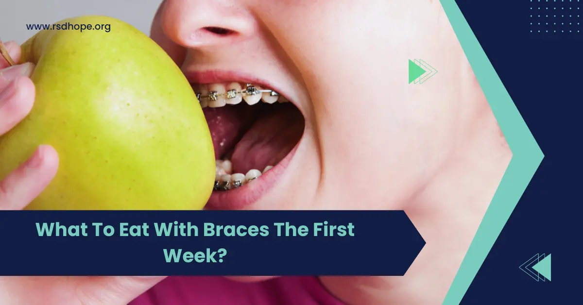 What To Eat With Braces The First Week