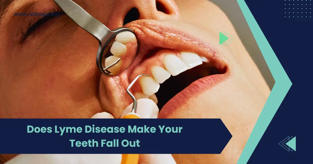 Does Lyme Disease Make Your Teeth Fall Out