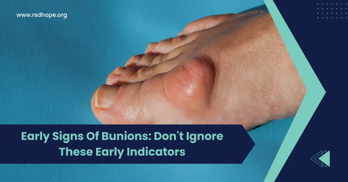 Early Signs Of Bunions