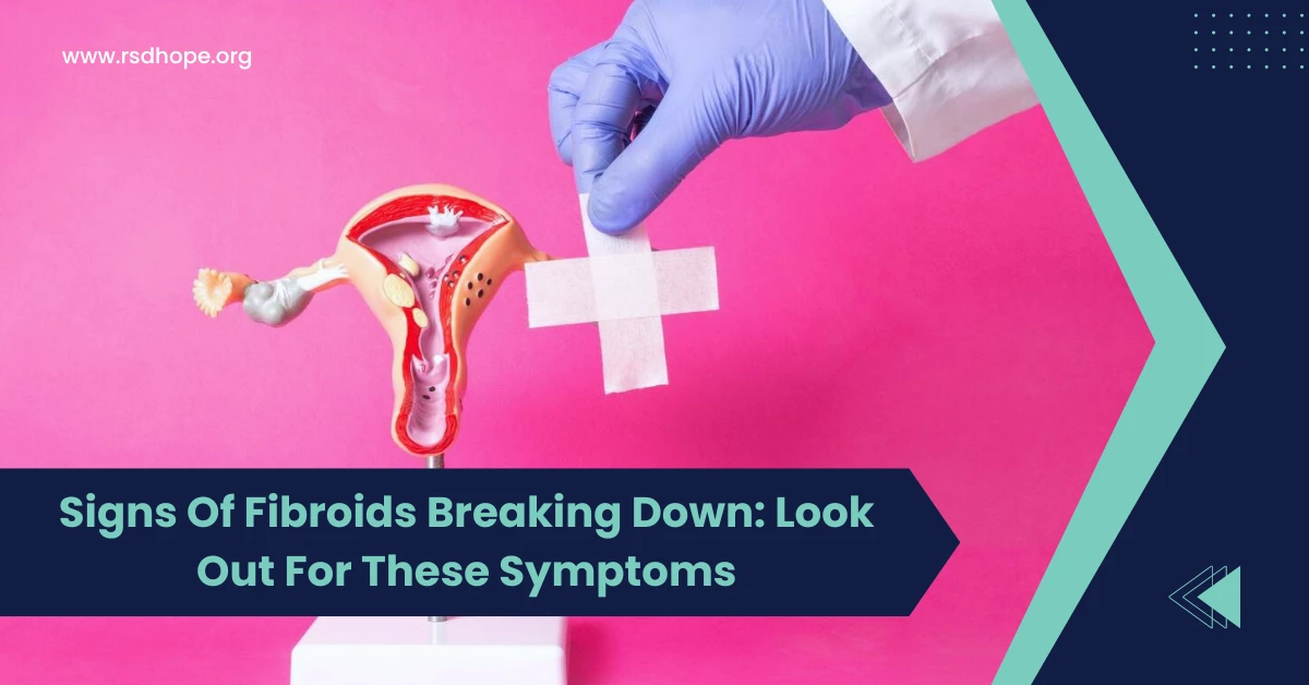 Signs Of Fibroids Breaking Down